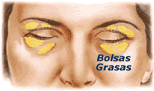 Cirugía Plástica Ocular Blefaroplastia