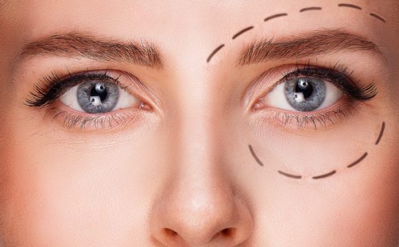 Cirugía Plástica Ocular – Oculoplastia