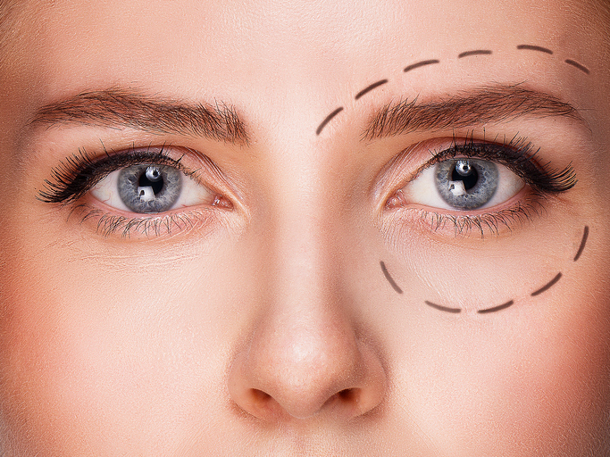 Cirugía Plástica Ocular – Oculoplastia