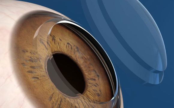 Cirugía de ojos para mejorar tu visión y dejar de usar lentes, Inicio, Clinica Sancho
